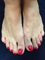  Педикюр женский (обработка ногтей и ступней + обработка мозолей и натоптышей), Покрытие ногтей "VINILUX"  (ноги),