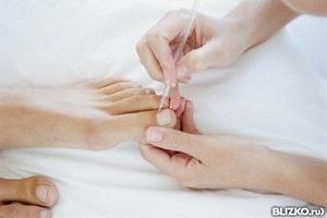 Обработка ногтей и пальцев ног